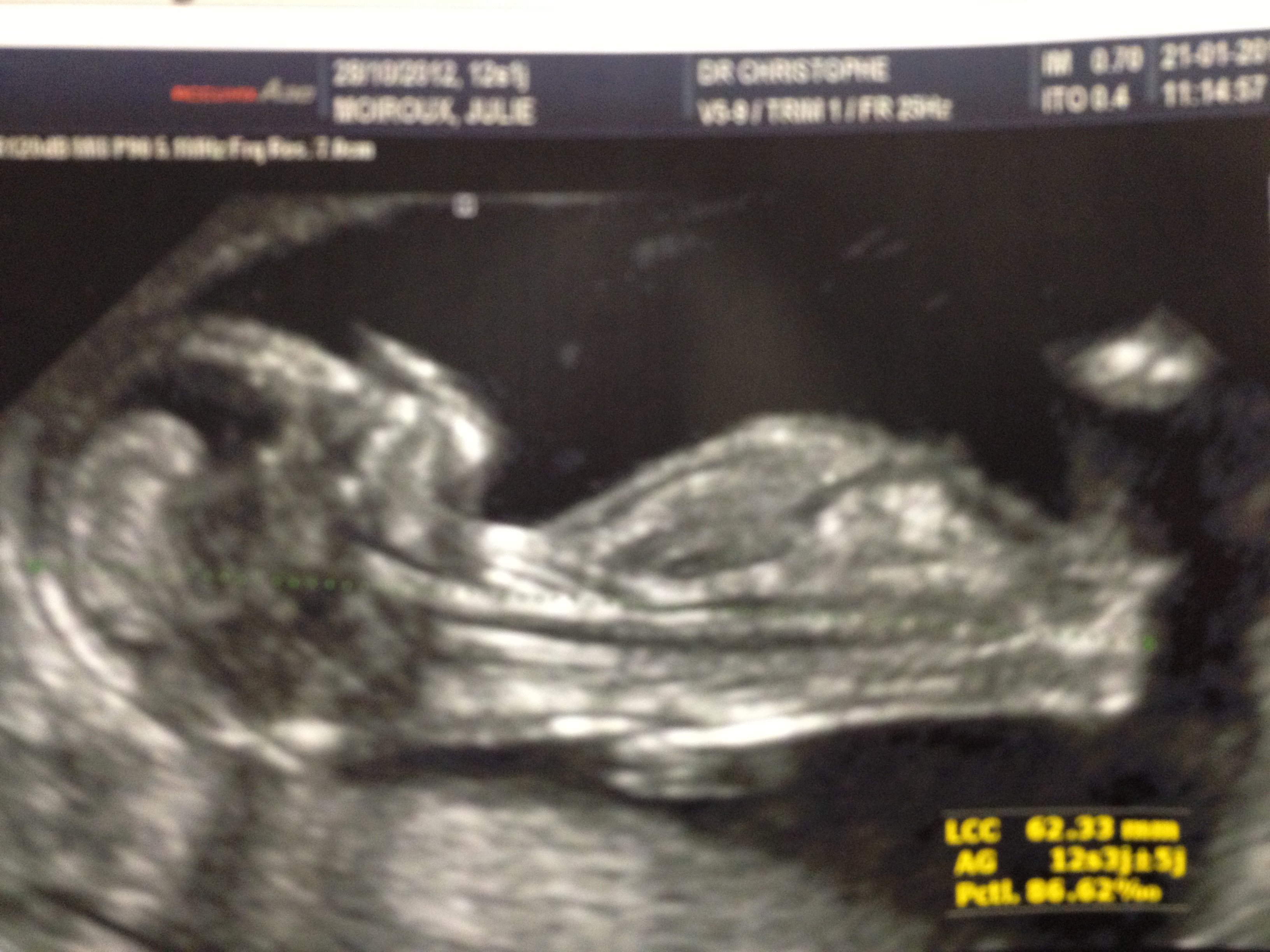 Nouvelle Echo 14sa 3 Echographie Connaitre Le Sexe De Votre Bebe Forum Grossesse Amp Bebe Doctissimo Nouvelle Echo 14sa 3 Echographie Connaitre Le Sexe De Votre Bebe Forum Grossesse Amp Bebe Doctissimo