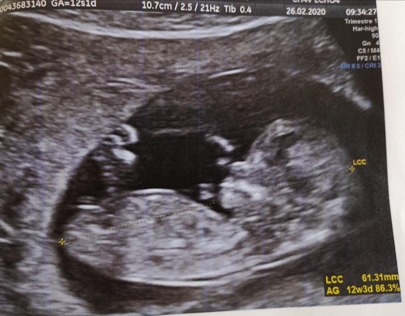 Echo A 12 Sa Bebe Fille Ou Garcon Echographie Connaitre Le Sexe De Votre Bebe Forum Grossesse Amp Bebe Doctissimo Echo A 12 Sa Bebe Fille Ou Garcon Echographie Connaitre Le Sexe De Votre Bebe Forum Grossesse Amp Bebe Doctissimo