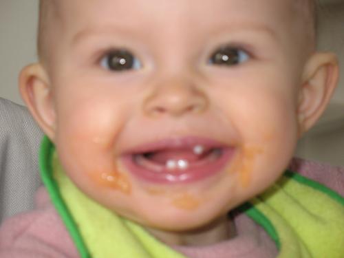Question Dents Bebe Grandit Forum Grossesse Amp Bebe Doctissimo Question Dents Bebe Grandit Forum Grossesse Amp Bebe Doctissimo