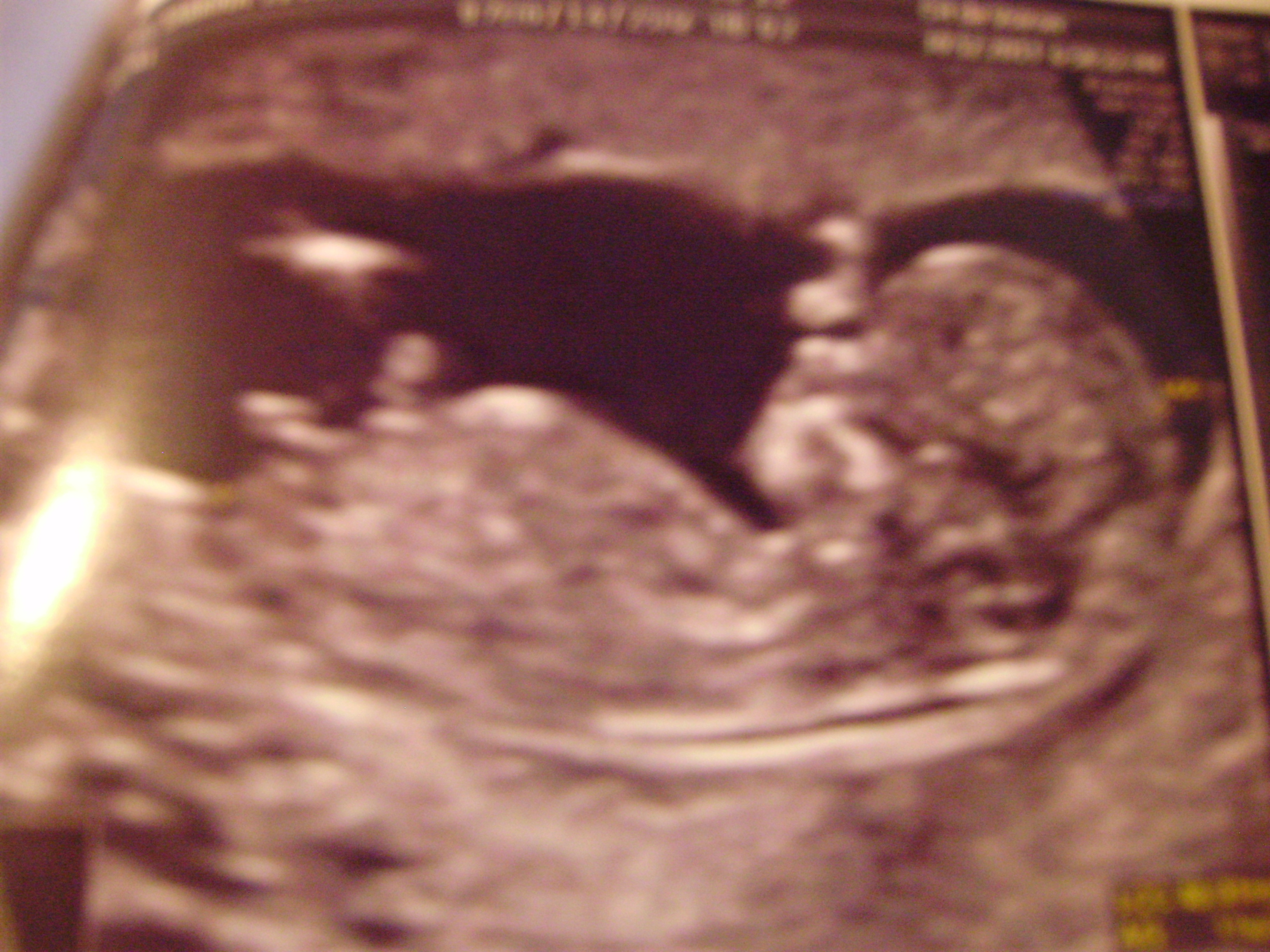 Avis Echo 11sa 4 Echographie Connaitre Le Sexe De Votre Bebe Forum Grossesse Amp Bebe Doctissimo