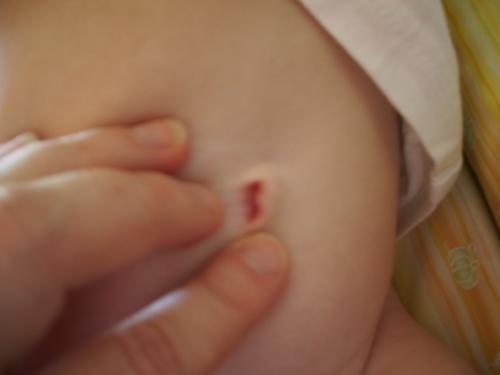 Regardez Ce Qu Elle A Clemence Bebe Grandit Forum Grossesse Amp Bebe Doctissimo