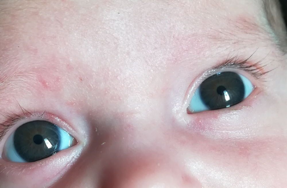 Avis Couleur Yeux Bebe 2 Mois Bebe Grandit Forum Grossesse Amp Bebe Doctissimo