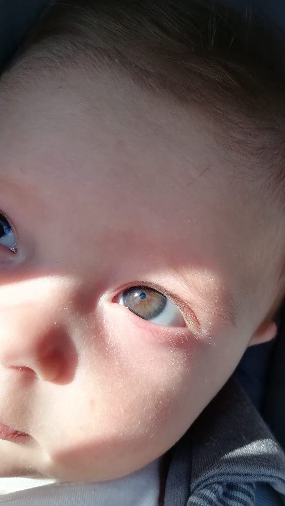 Avis Couleur Yeux Bebe 2 Mois Bebe Grandit Forum Grossesse Amp Bebe Doctissimo