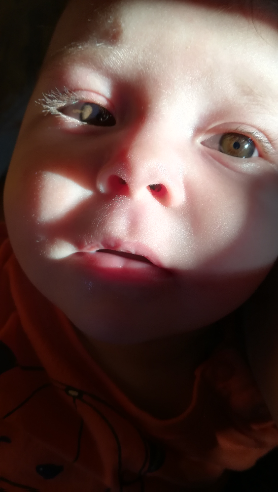 Avis Couleur Yeux Bebe 2 Mois Bebe Grandit Forum Grossesse Amp Bebe Doctissimo Avis Couleur Yeux Bebe 2 Mois Bebe Grandit Forum Grossesse Amp Bebe Doctissimo