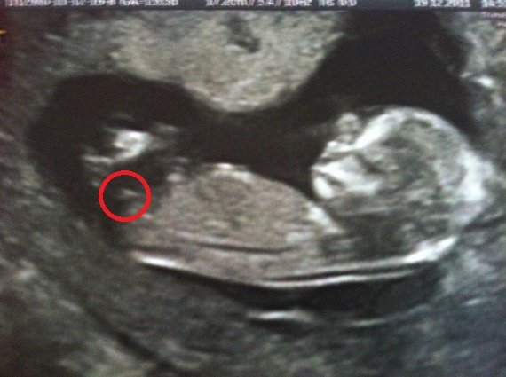 Sexe Bebe 14sa Sexe Bebe 14sa