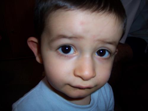 Tymeo Est Tombe Sur Le Nez Photos News Apres Visite Orl Bebe Grandit Forum Grossesse Amp Bebe Doctissimo