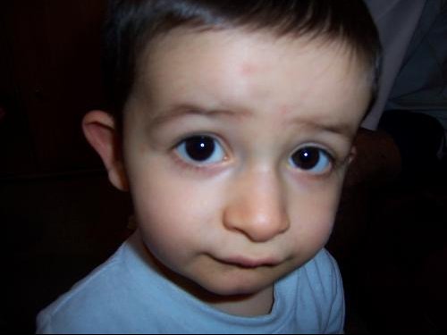 Tymeo Est Tombe Sur Le Nez Photos News Apres Visite Orl Bebe Grandit Forum Grossesse Amp Bebe Doctissimo Tymeo Est Tombe Sur Le Nez Photos News Apres Visite Orl Bebe Grandit Forum Grossesse Amp Bebe Doctissimo