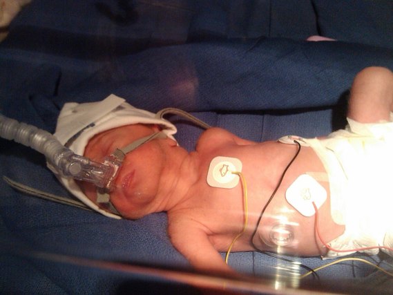 Mon Loulou Est Ne A 31 Sa Mon Loulou Est Ne A 31 Sa