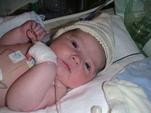 Photos Vraiment Moche De Nos A La Naissance Bebe Grandit Forum Grossesse Amp Bebe Doctissimo Photos Vraiment Moche De Nos A La Naissance Bebe Grandit Forum Grossesse Amp Bebe Doctissimo