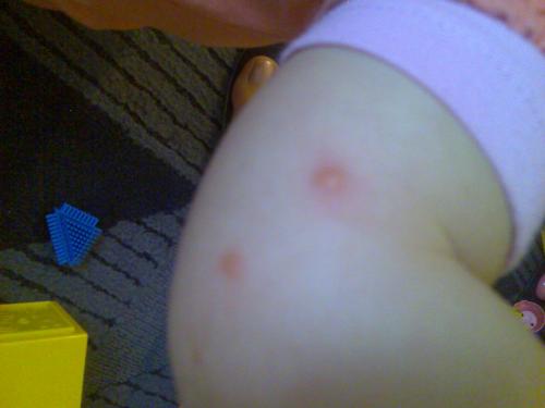 Bouton Bizard Sur Mon Bebe Sante De L Enfant Forum Sante Doctissimo Bouton Bizard Sur Mon Bebe Sante De L Enfant Forum Sante Doctissimo