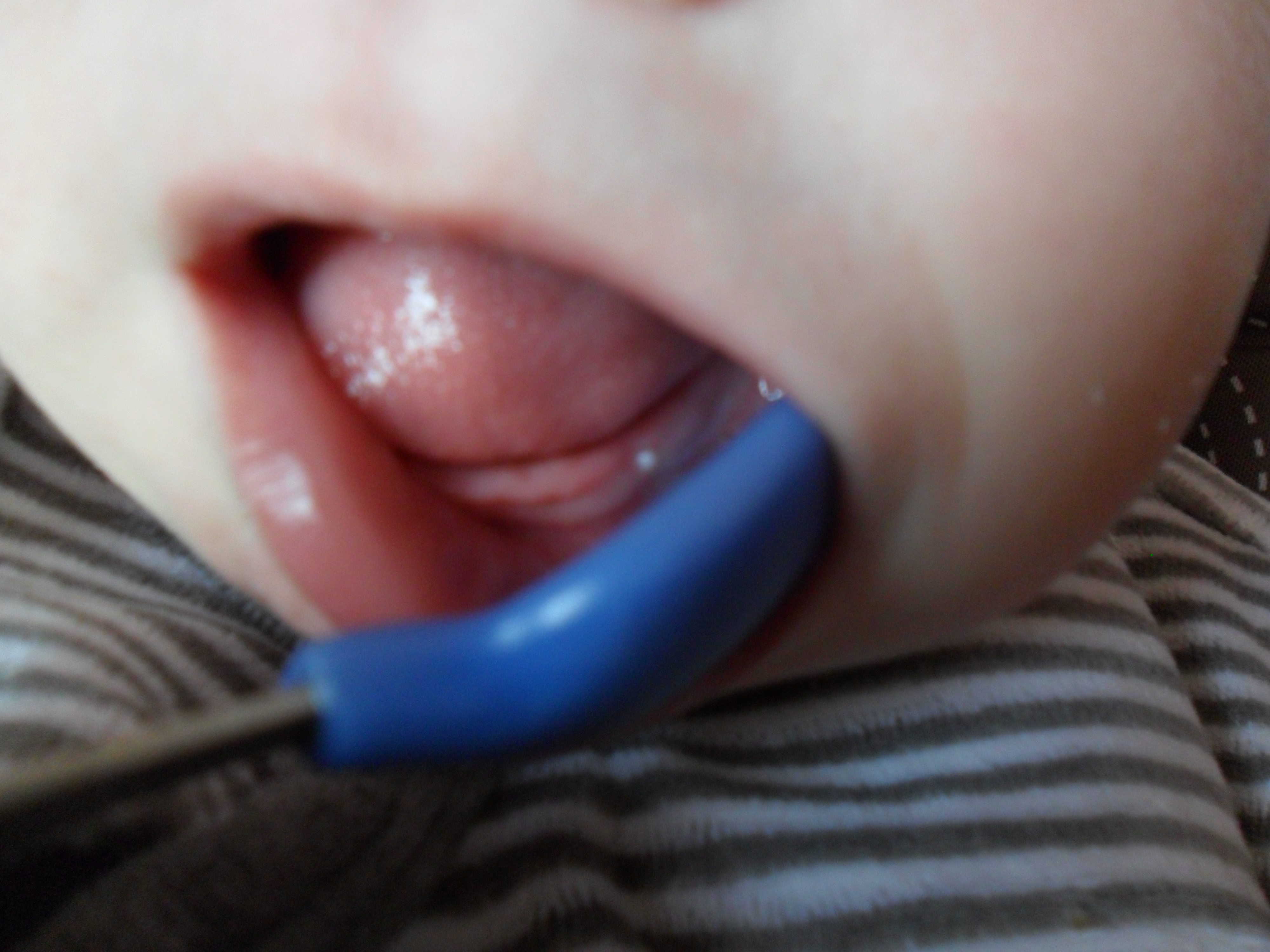 Y A Des Dents Dans Le Coin Bebe Grandit Forum Grossesse Amp Bebe Doctissimo Y A Des Dents Dans Le Coin Bebe Grandit Forum Grossesse Amp Bebe Doctissimo