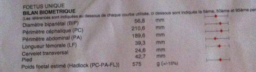 Poids Du Bebe A 24sa 5 Echographie Connaitre Le Sexe De Votre Bebe Forum Grossesse Amp Bebe Doctissimo Poids Du Bebe A 24sa 5 Echographie Connaitre Le Sexe De Votre Bebe Forum Grossesse Amp Bebe Doctissimo