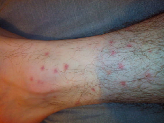 Petit bouton rouge - Tiffany Franklin