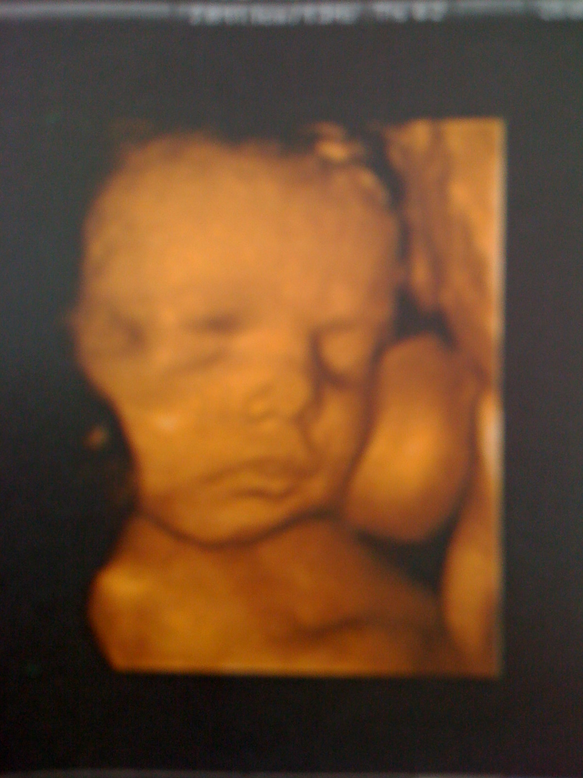 Mon Echographie Des 32 Sa Futures Mamans Forum Grossesse Amp Bebe Doctissimo Mon Echographie Des 32 Sa Futures Mamans Forum Grossesse Amp Bebe Doctissimo