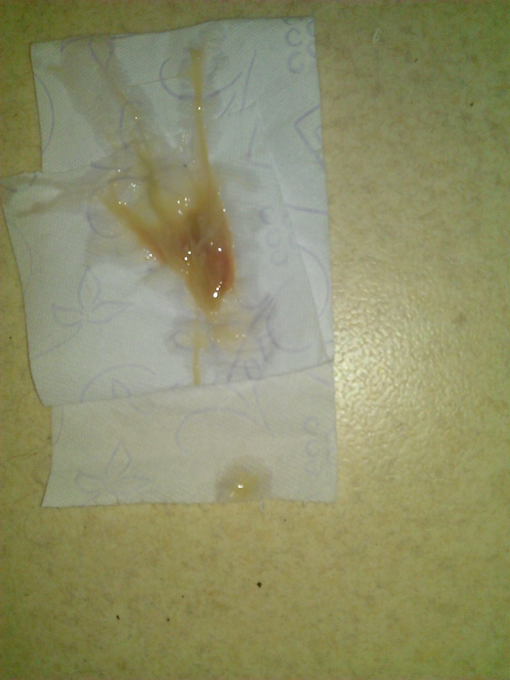 Question Bete Mais Urgente Accouchement Forum Grossesse Bebe