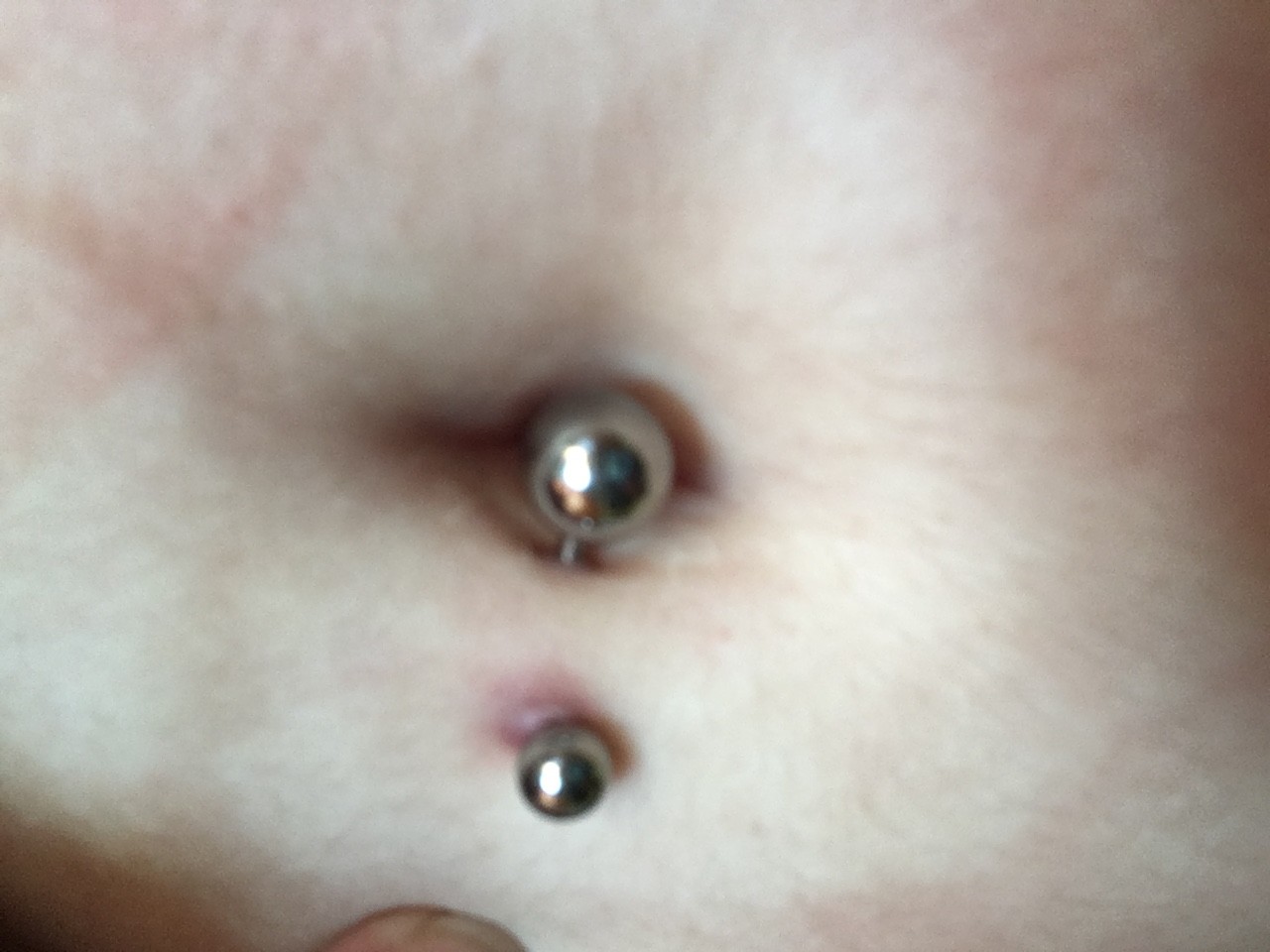 Piercing Nombril Cicatrisation Tres Difficile Tatouages Et Piercings Forum Beaute Doctissimo