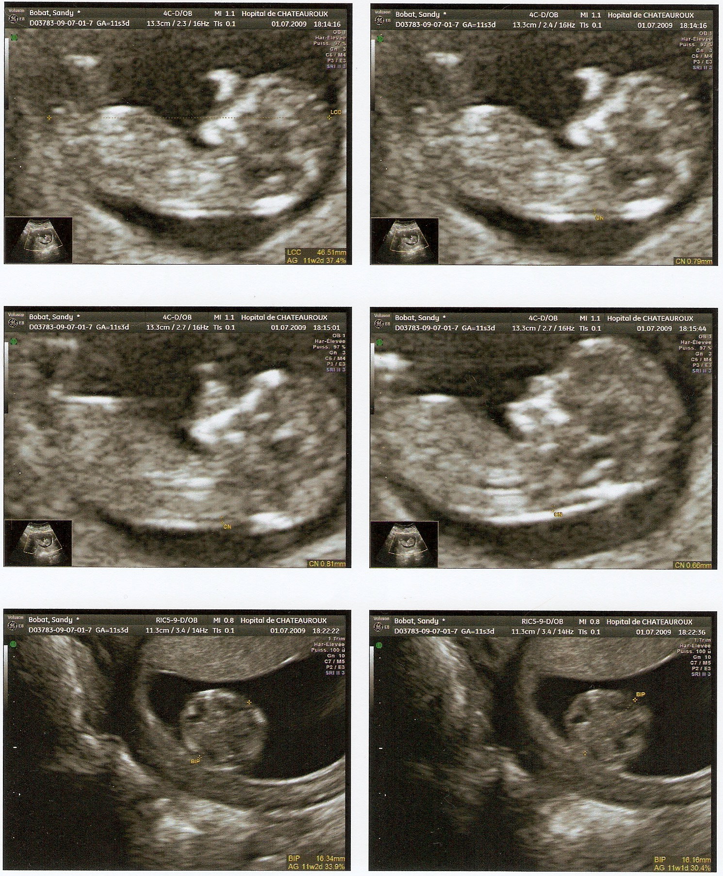 Eco Des 12 Sa Voyez Vous Un Gars Ou Une Fille Echographie Connaitre Le Sexe De Votre Bebe Forum Grossesse Amp Bebe Doctissimo Eco Des 12 Sa Voyez Vous Un Gars Ou Une Fille Echographie Connaitre Le Sexe De Votre Bebe Forum Grossesse Amp Bebe Doctissimo