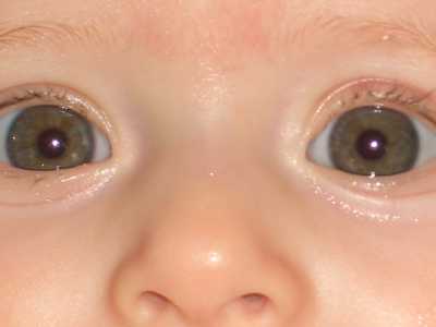Couleur Des Yeux De Vos Bebes Bebe Grandit Forum Grossesse Amp Bebe Doctissimo Couleur Des Yeux De Vos Bebes Bebe Grandit Forum Grossesse Amp Bebe Doctissimo
