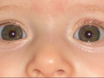 Evolution De La Couleur Des Yeux Bebe Grandit Forum Grossesse Amp Bebe Doctissimo Evolution De La Couleur Des Yeux Bebe Grandit Forum Grossesse Amp Bebe Doctissimo