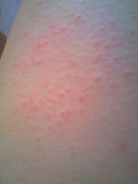 Petit bouton rouge - Tiffany Franklin