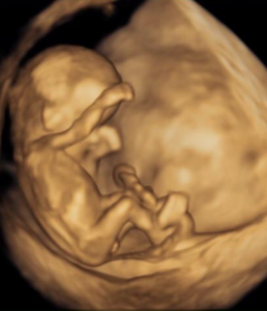 Sexe Du Bebe 11 Sa 5 Votre Avis Echographie Connaitre Le Sexe De Votre Bebe Forum Grossesse Amp Bebe Doctissimo
