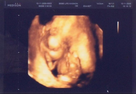 Verdict A 14sa Echo 3d Verdict A 14sa Echo 3d