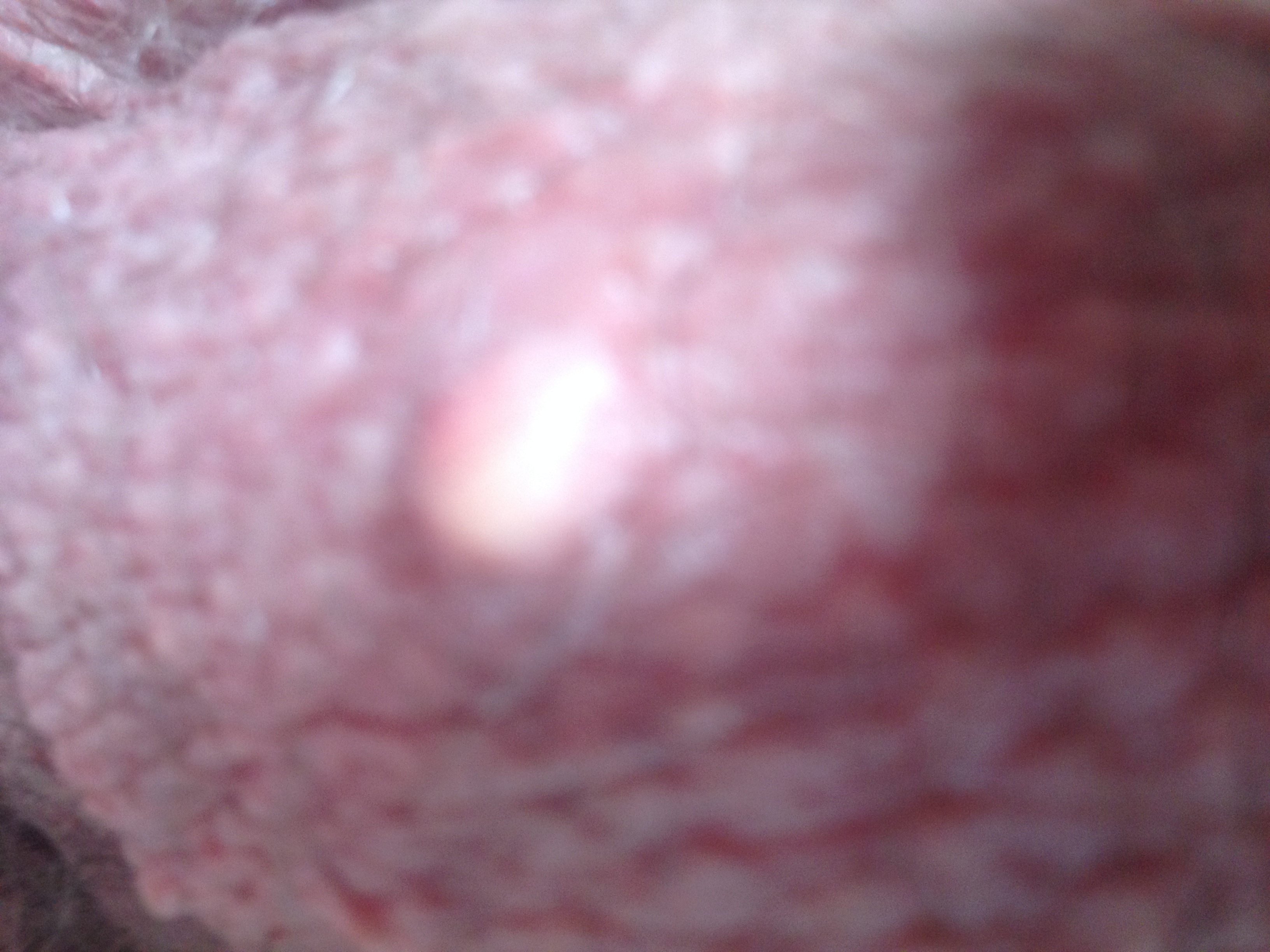 Probleme Bouton Blanc Sur Testicule Acne Psoriasis Et Problemes De Peau Forum Sante Doctissimo Probleme Bouton Blanc Sur Testicule Acne Psoriasis Et Problemes De Peau Forum Sante Doctissimo