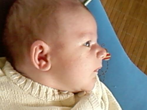 Problemes De Peau Bebe D 1 Mois Sante De L Enfant Forum Sante Doctissimo Problemes De Peau Bebe D 1 Mois Sante De L Enfant Forum Sante Doctissimo