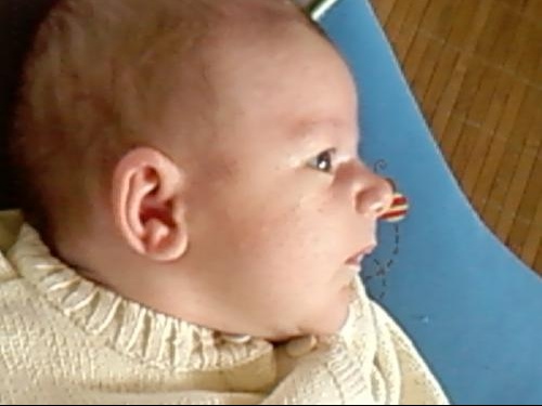 Problemes De Peau Bebe D 1 Mois Sante De L Enfant Forum Sante Doctissimo Problemes De Peau Bebe D 1 Mois Sante De L Enfant Forum Sante Doctissimo