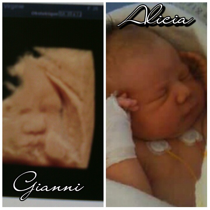 Les Plus Selectionnes Echographie 3d Bebe Gros Nez Les Plus Selectionnes Echographie 3d Bebe Gros Nez