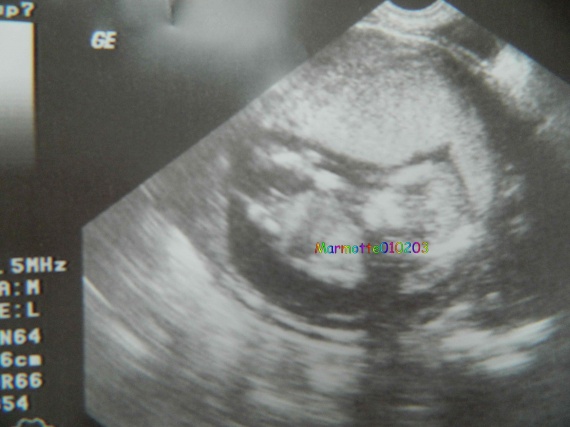 Echo 14 Sa Fille Ou Garcons Echo 14 Sa Fille Ou Garcons