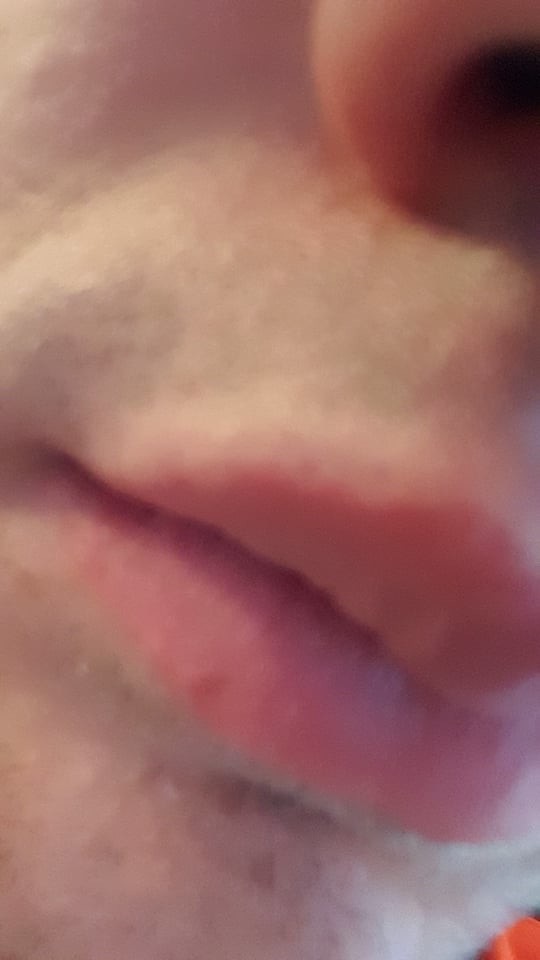 Point Noir Levre Et Nez Soin Du Visage Forum Beaute Doctissimo Point Noir Levre Et Nez Soin Du Visage Forum Beaute Doctissimo