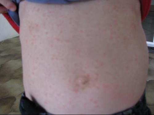 Enfants Et Maladies Bebe Grandit Forum Grossesse Amp Bebe Doctissimo Enfants Et Maladies Bebe Grandit Forum Grossesse Amp Bebe Doctissimo