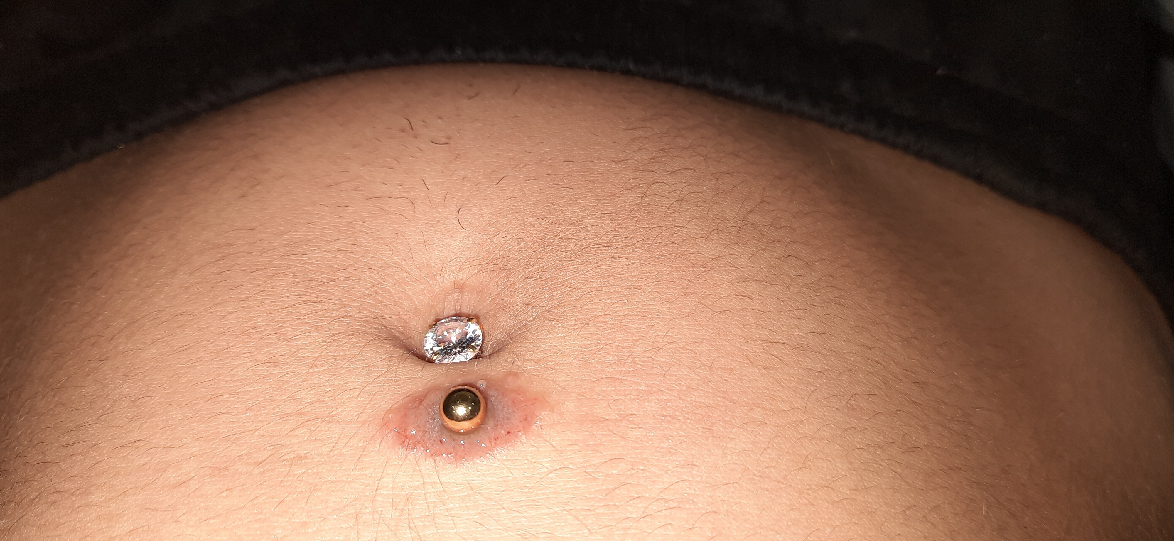Heeeelp Piercing Nombril Allergies Et Eczema Forum Sante Doctissimo