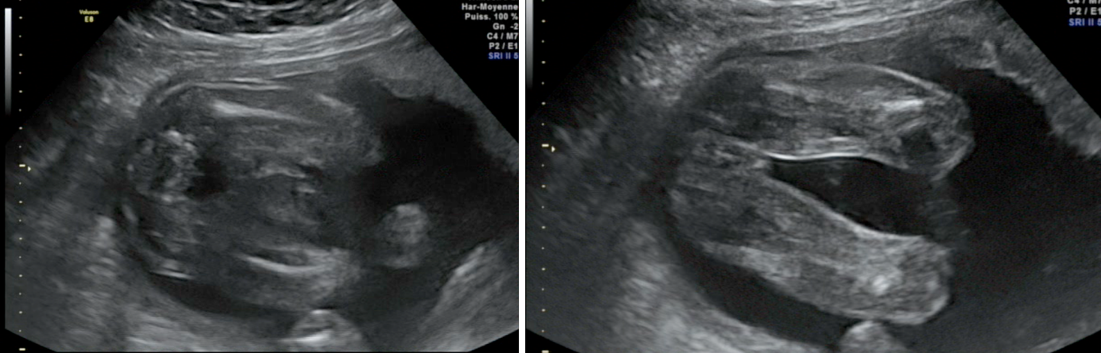 Que Voyez Vous 22 Sa Echographie Connaitre Le Sexe De Votre Bebe Forum Grossesse Amp Bebe Doctissimo Que Voyez Vous 22 Sa Echographie Connaitre Le Sexe De Votre Bebe Forum Grossesse Amp Bebe Doctissimo