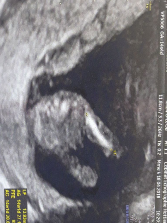 Fille Ou Garcon 14sa Fille Ou Garcon 14sa