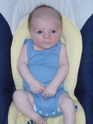 Ma Fille De 2 Mois Et Demi Devient Kojac Sos Bebe Grandit Forum Grossesse Amp Bebe Doctissimo Ma Fille De 2 Mois Et Demi Devient Kojac Sos Bebe Grandit Forum Grossesse Amp Bebe Doctissimo