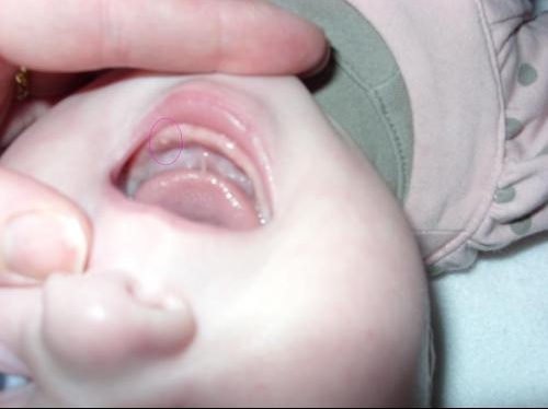 1ere Dent En Photo Bebe Grandit Forum Grossesse Amp Bebe Doctissimo 1ere Dent En Photo Bebe Grandit Forum Grossesse Amp Bebe Doctissimo