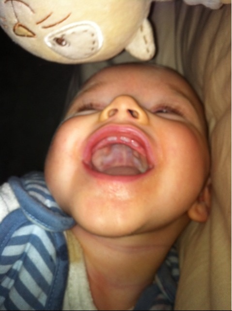 Dent Sourire De Vos Bibous Bebe Grandit Forum Grossesse Amp Bebe Doctissimo Dent Sourire De Vos Bibous Bebe Grandit Forum Grossesse Amp Bebe Doctissimo