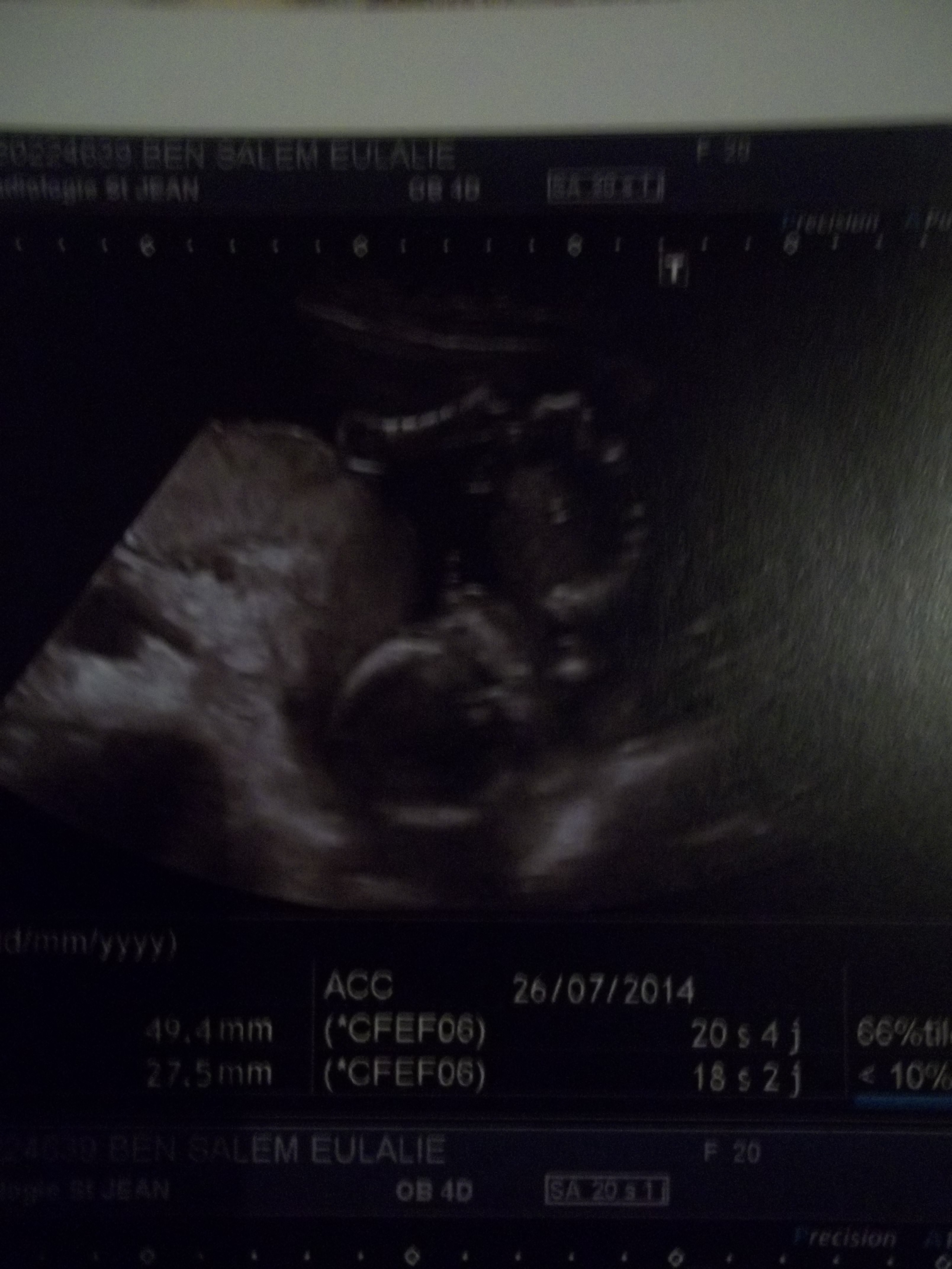 Grosse Peur Futures Mamans Forum Grossesse Amp Bebe Doctissimo Grosse Peur Futures Mamans Forum Grossesse Amp Bebe Doctissimo