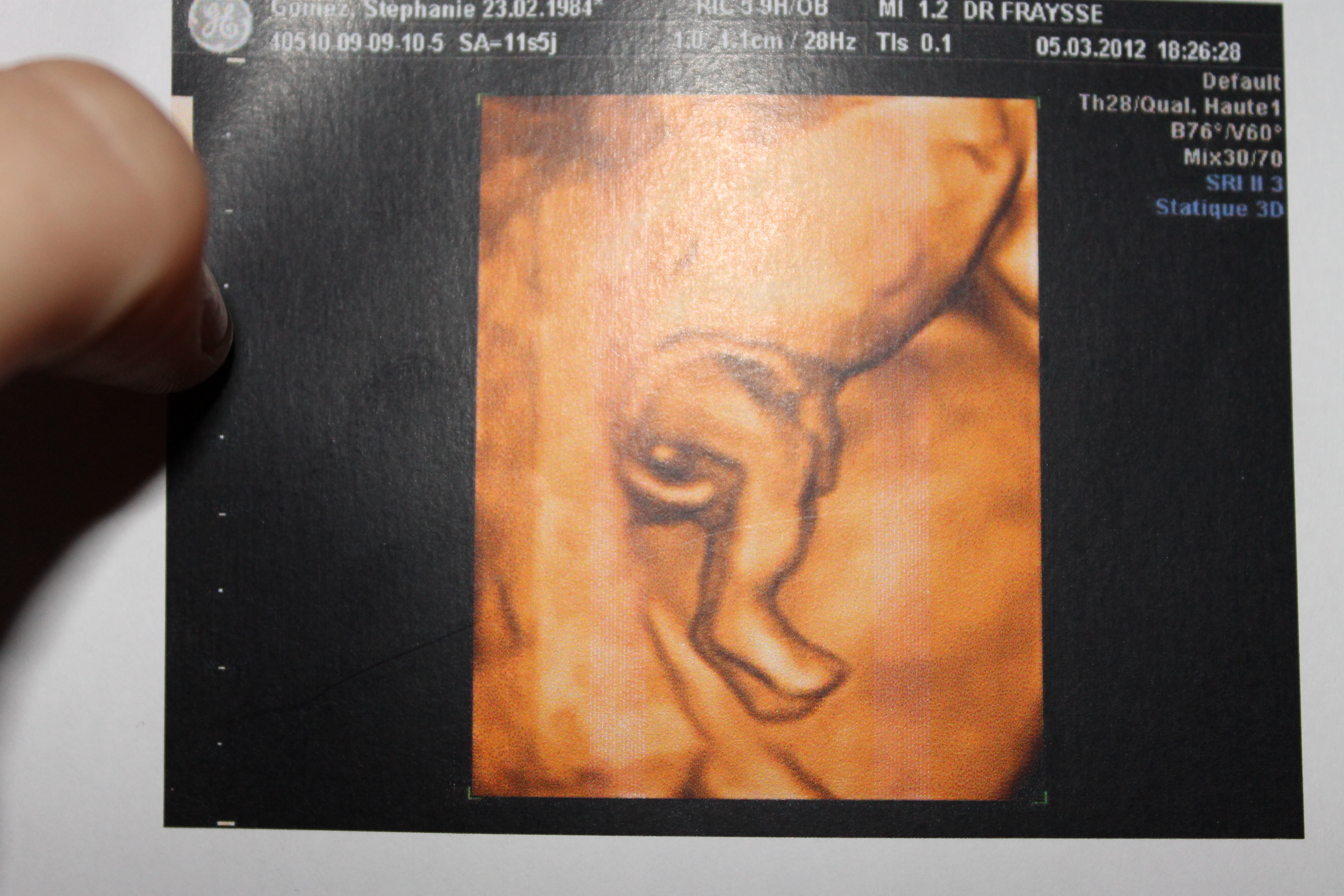 Le Gygy Change D Avis Edit Echo 19sa Tjrs Pas Sur Photos Futures Mamans Forum Grossesse Amp Bebe Doctissimo