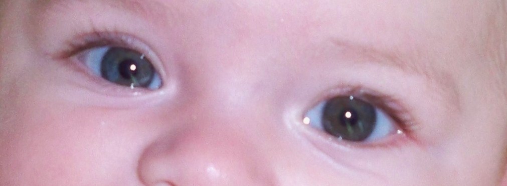 Question Sur Les Yeux Tache Bleu Dans Oeil Brun Photo Mamans Et Futures Mamans Du Quebec Forum Grossesse Amp Bebe Doctissimo