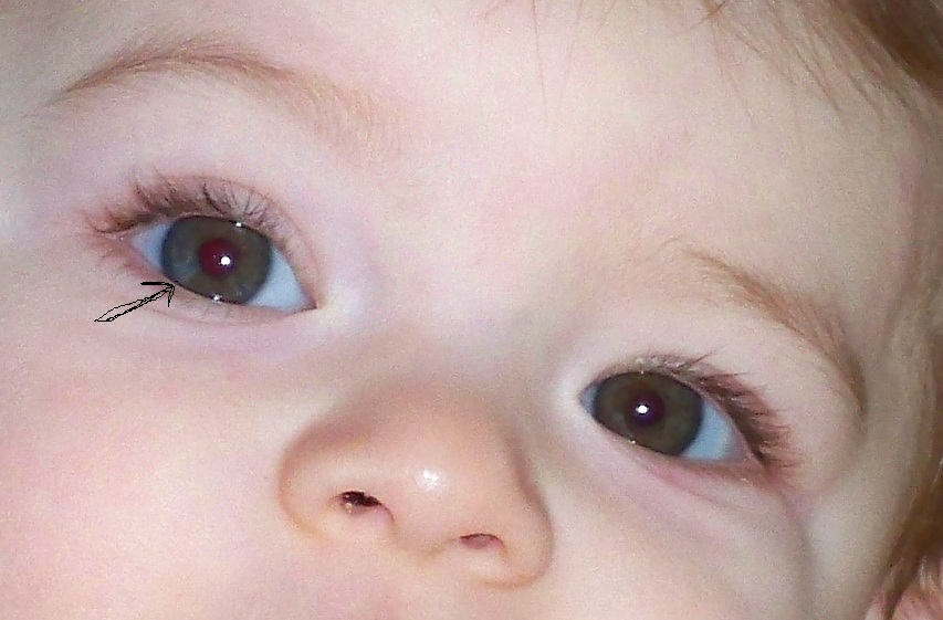 Question Sur Les Yeux Tache Bleu Dans Oeil Brun Photo Mamans Et Futures Mamans Du Quebec Forum Grossesse Amp Bebe Doctissimo Question Sur Les Yeux Tache Bleu Dans Oeil Brun Photo Mamans Et Futures Mamans Du Quebec Forum Grossesse Amp Bebe Doctissimo