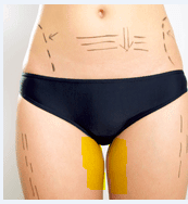 Maigrir Haut Des Cuisses Musculation Forum Forme Sport