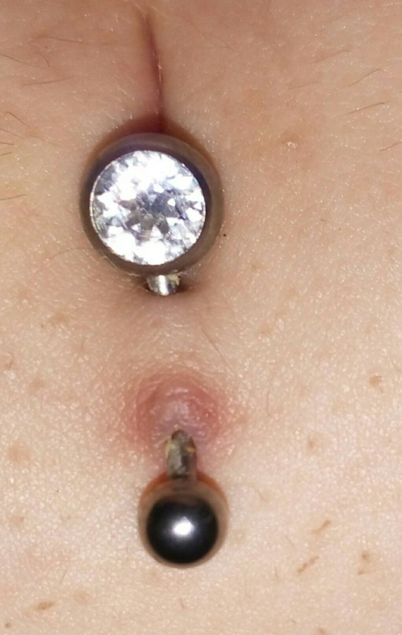 Excès de peau piercing nombril - Tatouages et piercings - FORUM ...