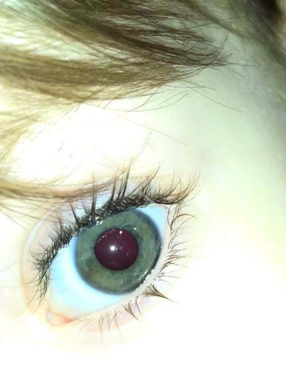 Avis Couleur Yeux Bebe 2 Mois Avis Couleur Yeux Bebe 2 Mois