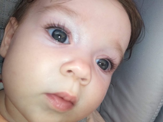 Avis Couleur Yeux Bebe 2 Mois Avis Couleur Yeux Bebe 2 Mois