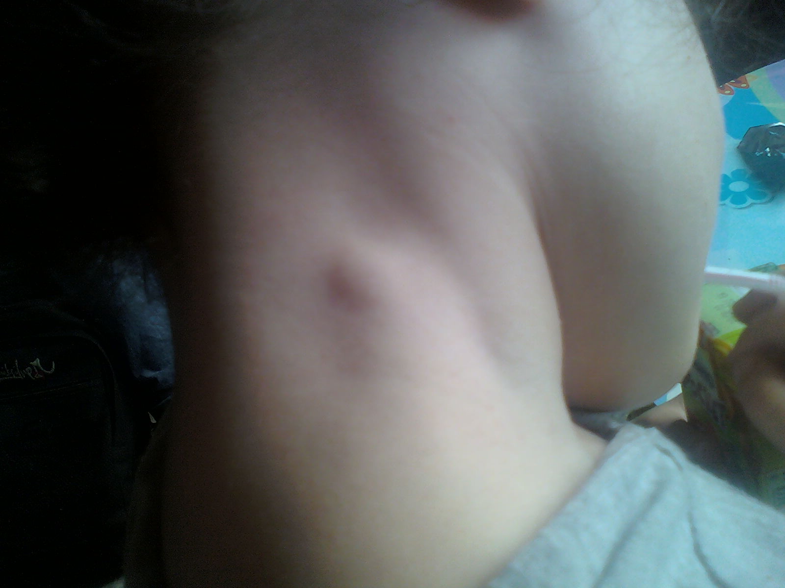 Tres Inquietes Photo Ci Joint Sante De L Enfant Forum Sante Doctissimo Tres Inquietes Photo Ci Joint Sante De L Enfant Forum Sante Doctissimo