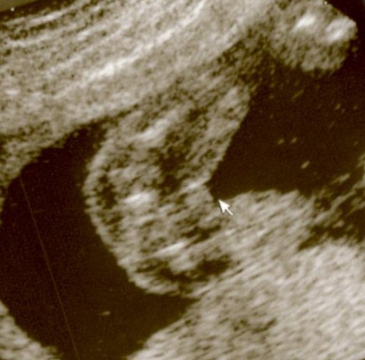 Je Sais Enfin Le Sexe De A 19sa Echographie Connaitre Le Sexe De Votre Bebe Forum Grossesse Amp Bebe Doctissimo Je Sais Enfin Le Sexe De A 19sa Echographie Connaitre Le Sexe De Votre Bebe Forum Grossesse Amp Bebe Doctissimo