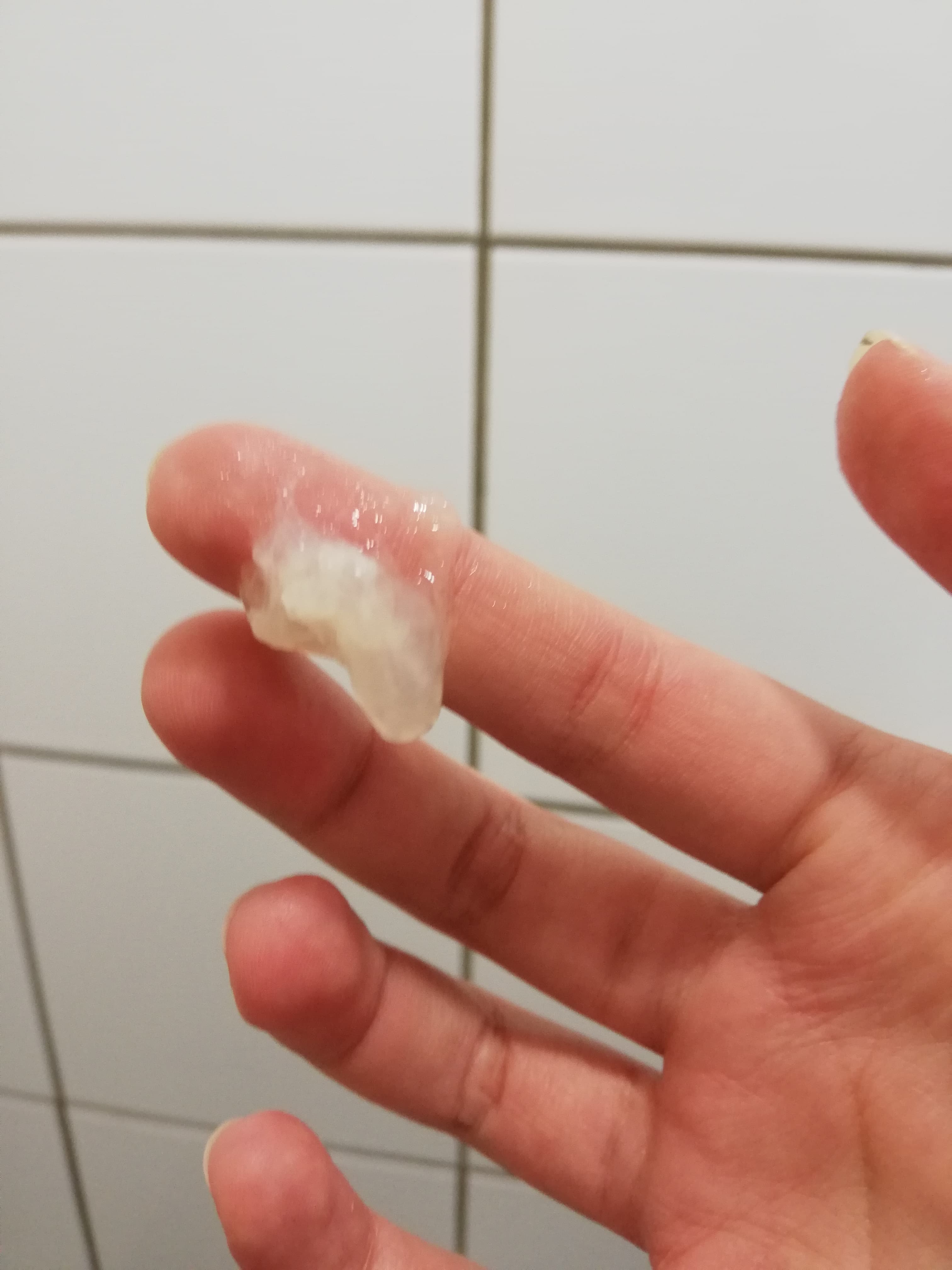 Pertes Blanches Tres Opaques Et Gluantes Regles Et Problemes Gynecologiques Forum Sante Doctissimo